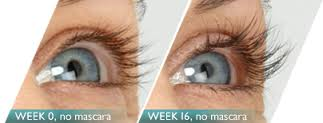 Latisse Before And After Photo In Des Moines And Ankeny, Iowa