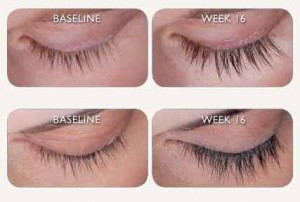 Latisse eyelash before and after photo in Des Moines and Ankeny, Iowa