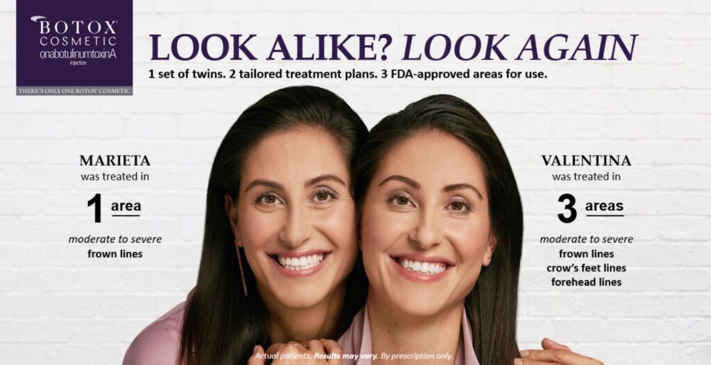 botox twins before and after