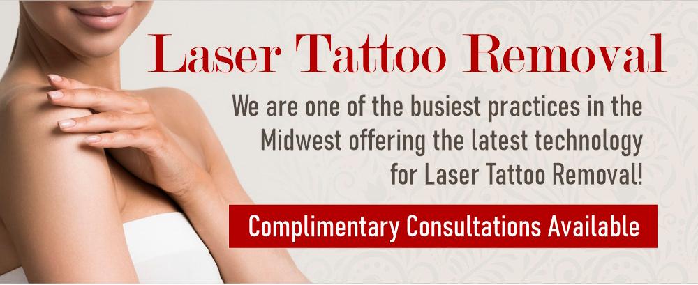 laser tattoo removal iowa