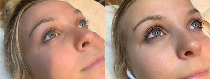 lash lift before and after photographs