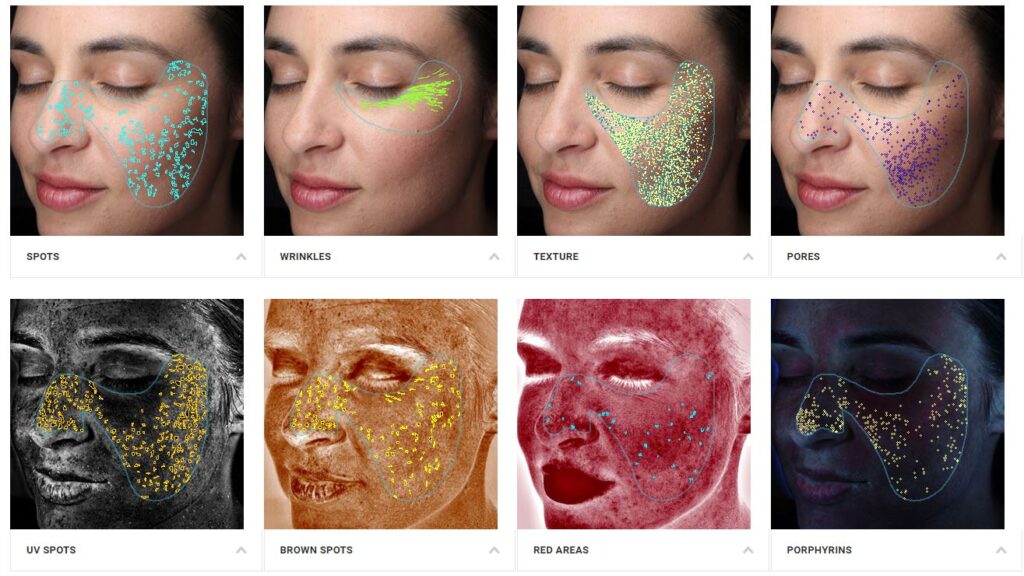 Ankeny Skincare Consultations 1 Visia Skin Analysis