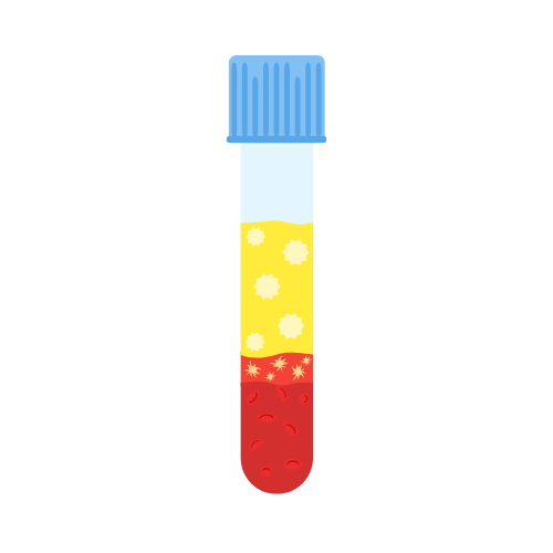 Prf Treatments 4 Prf