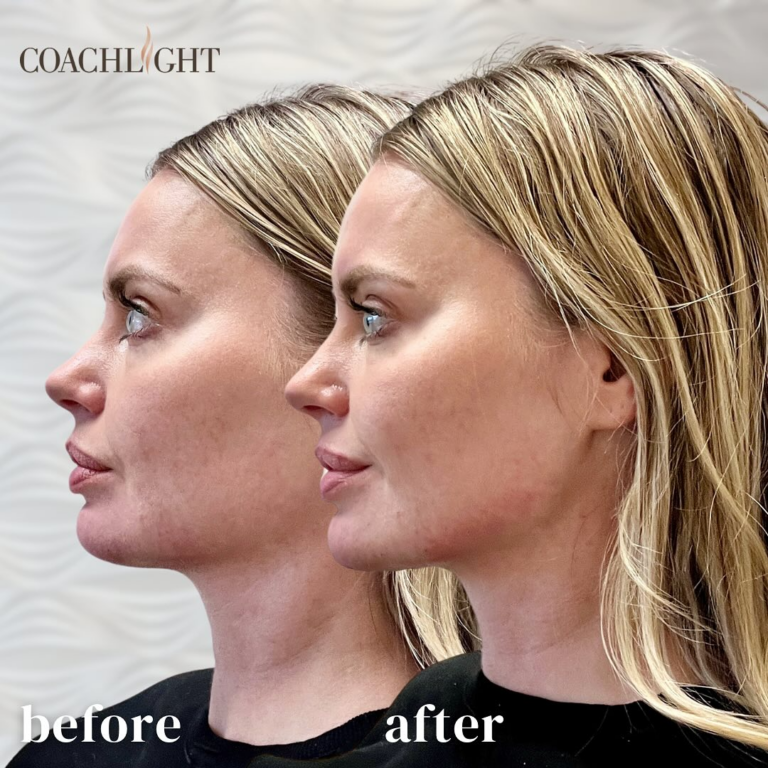 Facial Balancing: What Is It? 2 Facial Balancing