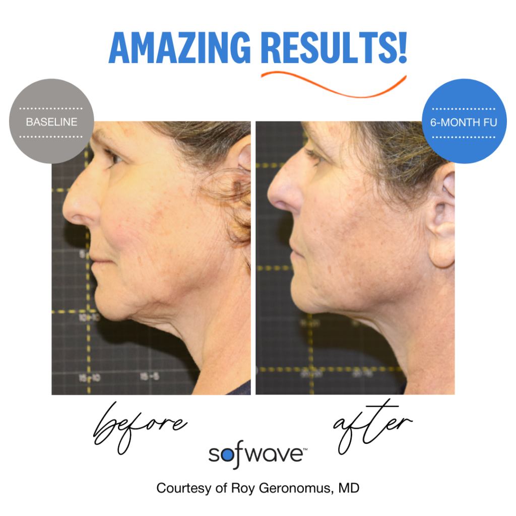 Before And After Graphic