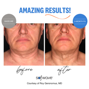 Before and After Graphic