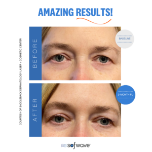 Set Eyebrow