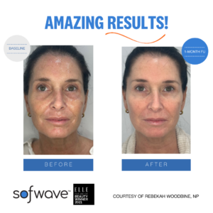 Set Full Face