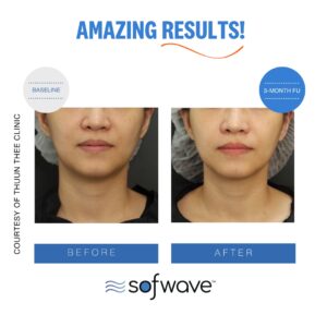 Set Lower Face Skin Type