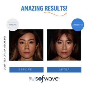 Set Full Face Skin Type