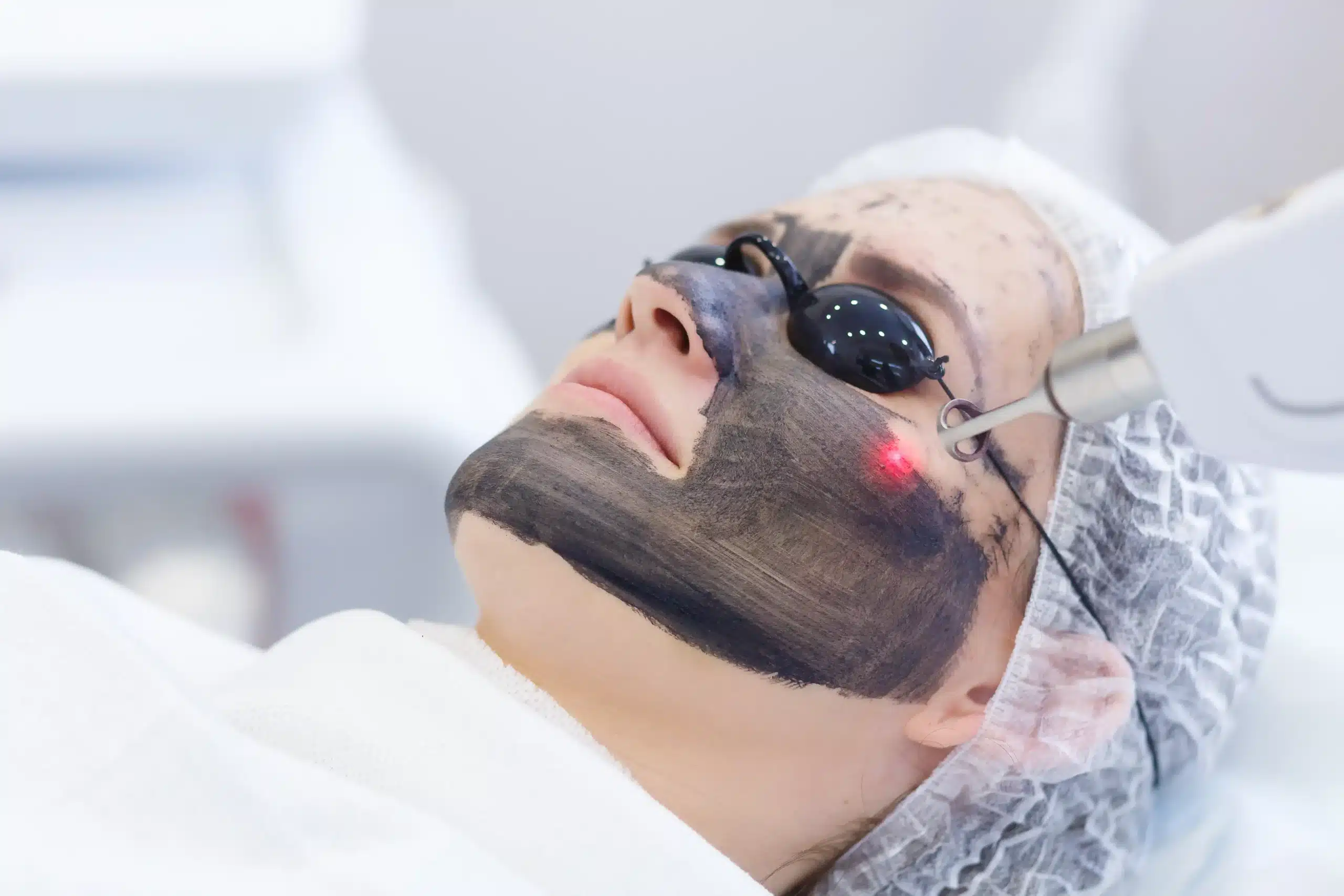 Laser Treatment