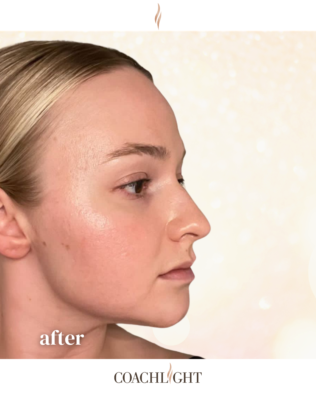 Jawline ()