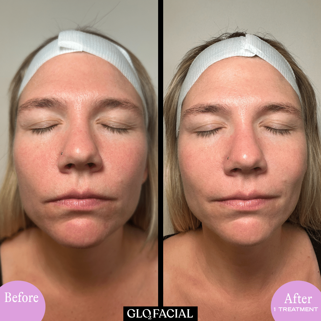 A Woman With Her Eyes Closed