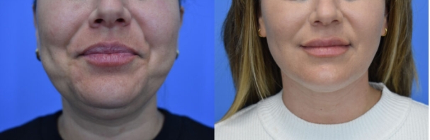 Specials &Amp; Events 5 Screenshot 1 4 2026 8421 Www.dsmplasticsurgery.com